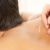 Acupuncture and Cupping: Enhance Your Sports Recovery
